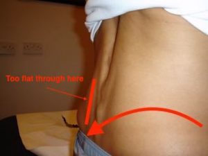 video, analysis, treatment, back pain