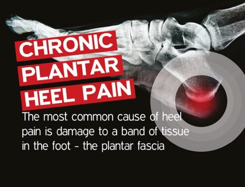 Plantar Heel Pain or Plantar Fasciitis – a physiotherapists perspective.