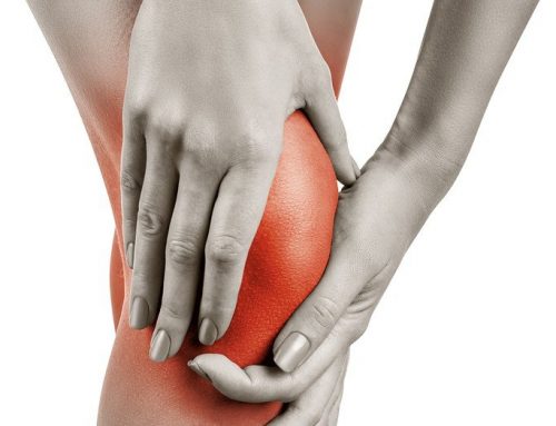 Iliotibial Band Syndrome (ITBS) – physiotherapy management advice.